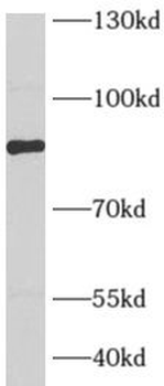 AFG3L2 Rabbit Polyclonal Antibody