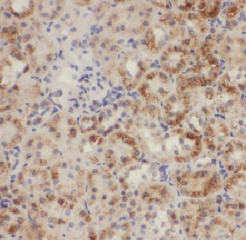 AFG3L2 Rabbit Polyclonal Antibody