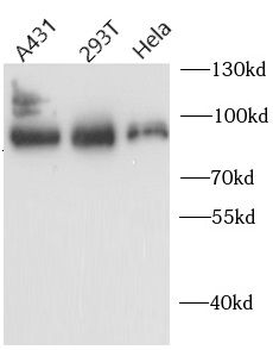 AFM Rabbit Polyclonal Antibody