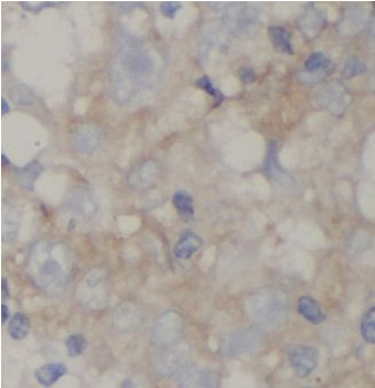 AFM Rabbit Polyclonal Antibody