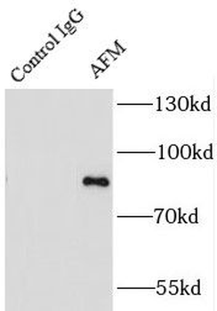 AFM Rabbit Polyclonal Antibody