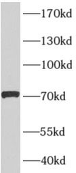 AFM Rabbit Polyclonal Antibody