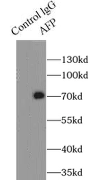 AFP Rabbit Polyclonal Antibody