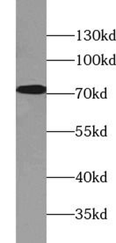 AFP Rabbit Polyclonal Antibody