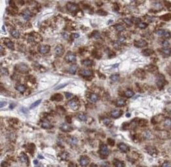 AFP Rabbit Polyclonal Antibody