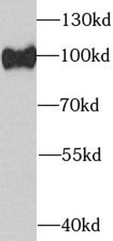 AGO2 Rabbit Polyclonal Antibody