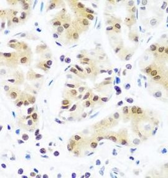 AGO2 Rabbit Polyclonal Antibody
