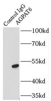 GPAT4 Rabbit Polyclonal Antibody