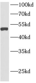 GPAT4 Rabbit Polyclonal Antibody