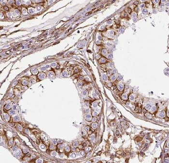 GPAT4 Rabbit Polyclonal Antibody