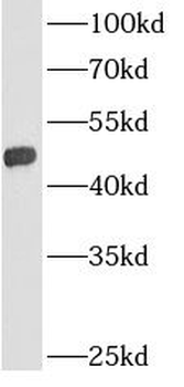 GPAT3 Rabbit Polyclonal Antibody