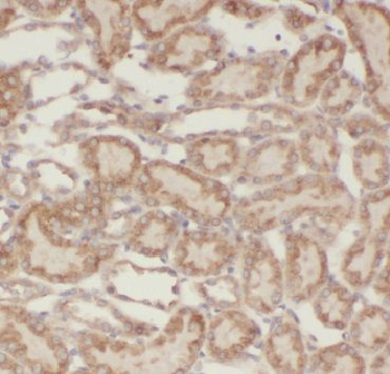 GPAT3 Rabbit Polyclonal Antibody