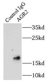 AGR2 Rabbit Polyclonal Antibody