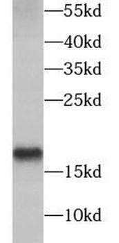 AGR2 Rabbit Polyclonal Antibody