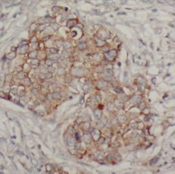 AGR2 Rabbit Polyclonal Antibody