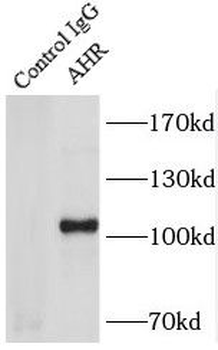 AHR Rabbit Polyclonal Antibody