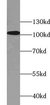 AHR Rabbit Polyclonal Antibody