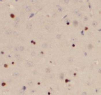 AHR Rabbit Polyclonal Antibody