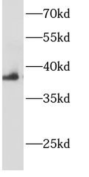 AHSA1 Rabbit Polyclonal Antibody