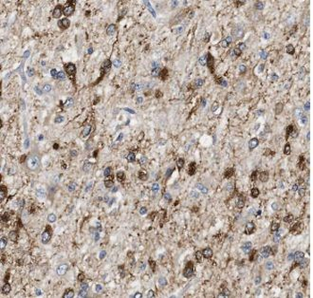 AHSA1 Rabbit Polyclonal Antibody