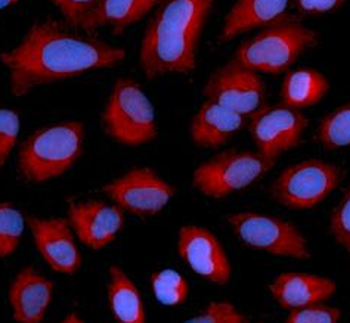AIFM1 Rabbit Polyclonal Antibody