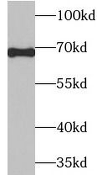 AIFM1 Rabbit Polyclonal Antibody