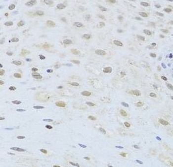 AIFM1 Rabbit Polyclonal Antibody