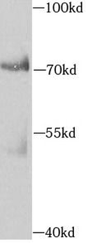 AIFM3 Rabbit Polyclonal Antibody