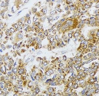 AIFM3 Rabbit Polyclonal Antibody