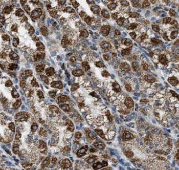 AJUBA Rabbit Polyclonal Antibody