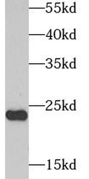 AK1 Rabbit Polyclonal Antibody