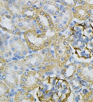AK1 Rabbit Polyclonal Antibody