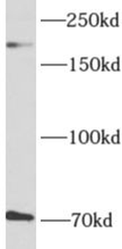 AKAP12 Rabbit Polyclonal Antibody
