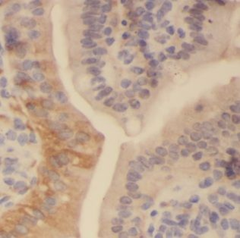 AKAP12 Rabbit Polyclonal Antibody