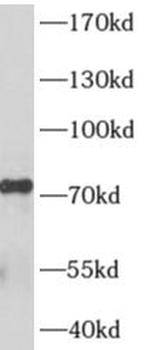 AKAP8L Rabbit Polyclonal Antibody