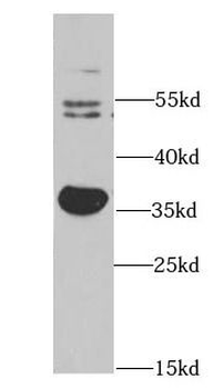 AKR1C3 Rabbit Polyclonal Antibody