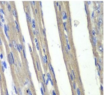 AKR1C3 Rabbit Polyclonal Antibody