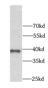 AKR7A2 Rabbit Polyclonal Antibody