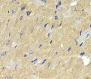 AKR7A2 Rabbit Polyclonal Antibody