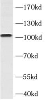 ALCAM Rabbit Polyclonal Antibody