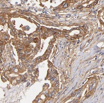 ALCAM Rabbit Polyclonal Antibody