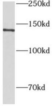 AOX1 Rabbit Polyclonal Antibody