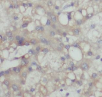 ALDH1A3 Rabbit Polyclonal Antibody