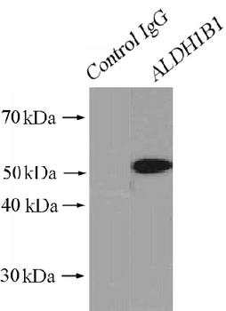 ALDH1B1 Rabbit Polyclonal Antibody