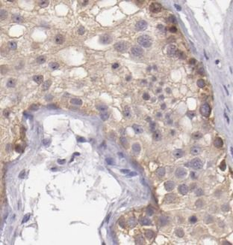 ALDH1B1 Rabbit Polyclonal Antibody