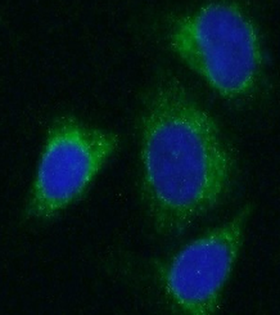 ALDH1B1 Rabbit Polyclonal Antibody