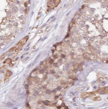 ALDH1B1 Rabbit Polyclonal Antibody