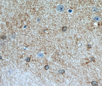 ALDH1L1 Rabbit Polyclonal Antibody