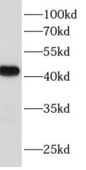ACTC1 Rabbit Polyclonal Antibody