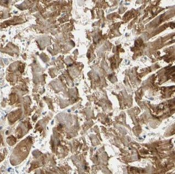 ACTC1 Rabbit Polyclonal Antibody